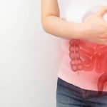 Rak-debelog-crijeva-bolovi-768×512