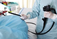 Trebali biste napraviti kolonoskopiju ako imate 2 od sljedeća simptoma: Čak i ako ste mlađi od 50 godina