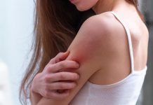 Zašto me tijelo svrbi nakon tuširanja? Ako i vi imate crvene mrlje, evo zašto