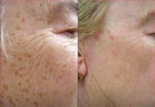 Za samo nekoliko sedmica možete efikasno ukloniti starenje sa lica i tijela pomoću domaće mješavine.