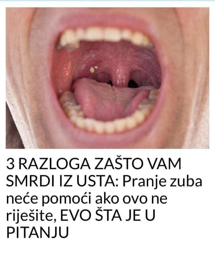fjr