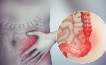 MUČE VAS NADUTOST, GASOVI I BOLOVI U STOMAKU? Možda imate sindrom nervoznog creva – Doktor savetuje