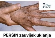 PERŠIN Zauvijek Uklanja STARAČKE MRLJE! Ovo Morate Napraviti…