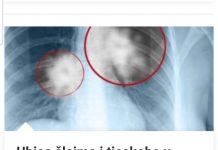 Ubica Šlajma I Tjeskobe U Grudima: Smjesa Od TRI Sastojka Liječi Vaša PLUĆA I Disajne Puteve