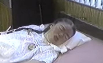 Sa 16 je obolela od gripa i pala u komu iz koje se nije budila 42 godine: Kad je otvorila oči, majka zanemela od prizora