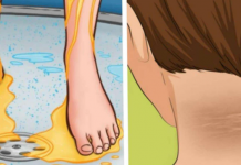 9 upozoravajućih znakova DIJABETESA!!0bratite pažnju dok još nije kasno