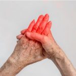 reuma-skodi-organizmu-kazdom-veku-1024×705