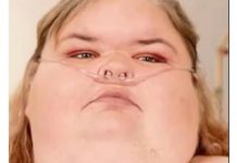 Godinama se gojila, a kad je prešla 300kg umre joj i muž od debljine: Ova žena je doktore šokirala transformacijom