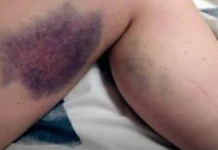 Vitamini koje je zabranjeno uzimati zajedno, ALI NIKO NE ZNA, MOGU BITI OPASNI