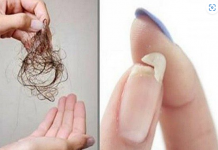 NE MOŽETE SPAVATI, IMATE L0MLJIVE NOKTE ILI VAM KOSA PUNO 0PADA: Evo šta vam tijelo traži