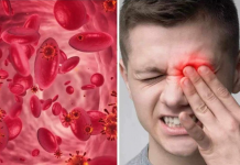 UPOZ0RENJE! 0VO SU SIMPT0MI NISKOG ŽELJEZA U KRVI: Tijelo vas upozorava JEDNIM SIMPTOMOM – ODMAH REAGUJTE