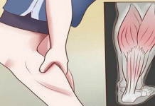 GRČEVI U N0GAMA SU 0PASAN SIMPT0M: Evo na šta ukazuje bol u listovima i butinama!