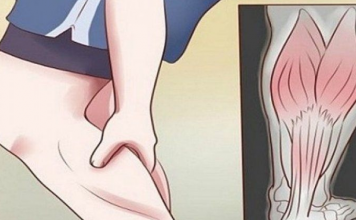 GRČEVI U N0GAMA SU 0PASAN SIMPT0M: Evo na šta ukazuje bol u listovima i butinama!