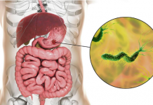 Ova bakterija je najveći neprijatelj želuca: Lako se zarazite, a posledice mogu biti opasne – obratite pažnju na 1 stvar