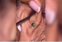 SVRBELO JE UVO, kada je otišla ljekaru Š0KIRALA SE: Kada su videli šta je unutra nisu mogli da veruju svojim očima! (FOTO)