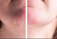 DLAČICE S LICA nestaju kao rukom odnesene:Sve žene širom svijeta potpuno su poludile za ovim receptom!