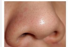 MITISERI SAMI ISPADAJU IZ PORA, ŽENA POKAZALA GENIJALAN TRIK: Uradite ove 3 stvari i oduševit ćete se licem (FOTO)