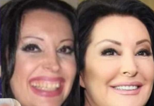 KAD SU SKUPILI PARE, URADILI SU ZUBE: POGLEDAJTE kako su izgledale domaće ličnosti PRIJE UMJETNIH ZUBA – CECA JE HIT (FOTO)