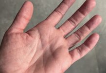 Samo zaista posebni ljudi imaju ovaj simbol na levom dlanu, njima se smeši veliki uspeh u životu, bogatstvo i sreća