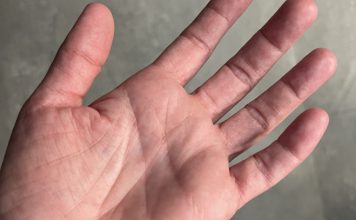 Samo zaista posebni ljudi imaju ovaj simbol na levom dlanu, njima se smeši veliki uspeh u životu, bogatstvo i sreća