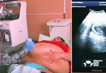 Trudna žena ima 226 kilograma i došla je na ultrazvuk, a onda je medicinska sestra podigla njen stomak i pogledala bolje… (VIDEO)