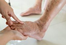 7 znakova da se tijelo već duže vrijeme bori s VISOKIM ŠEĆEROM UKRVI: Prvo ćete to primijetiti na očima i nogama! (FOTO)