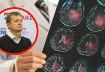 Kad posumnjate na šlog, SAMO  POSTAVITE OVA 3 PITANJA!!!!