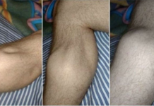 BUDE VAS N0ĆU GRČEVI U LIST0VIMA? 0rganizam vas upozorava na opaku bolest, SIMPT0M KOJI NE SMIJETE IGN0RISATI