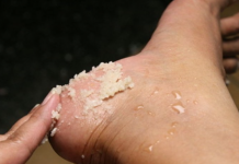 GENIJALAN RECEPT ZA GRUBE RUKE, ISPUCALE PETE, KURJE OČI I KRIVE NOKTE NA NOGAMA: Obavezno zapišite, nećete se pokajati