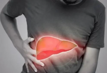 Prvi simptom MASNE JETRE vidi se na LICU obolelog – Znojenje i loš dah se najlakše prepoznaju, ali ove SIGNALE tela mnogi zanemare