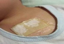 Ovaj kućni lijek rastvara sluz u plućima i oslobađa kašlja. Preko noći uklanja i najteži kašalj, te čisti pluća od nakupljene sluzi!