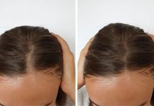 Zovu je “ŽIVA VODA”: Zaboravite skupe tretmane, ovo će zaustaviti opadanje kose i popraviti kosu – rezultati za 3 dana!