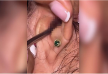 SVRBELO JE UVO DO BESVESTI, OTIŠLA U BOLNICU, A TAMO ŠOK: Kada su videli šta je unutra nisu mogli da veruju svojim očima! (FOTO)