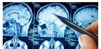 POVRĆE JE TOLIKO ZDRAVO DA O NJEMU PIŠE NJUJORK TAJMS: Amerikanci daju po 30 dolara za jedan list, a ono raste kod nas