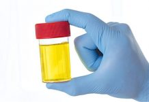 ZAŠTO IMATE JAK I NEPRIJATAN MIRIS URINA: Ovaj znak organizma ne smijete zanemariti! EVO NA ŠTA VAS UPOZORAVA