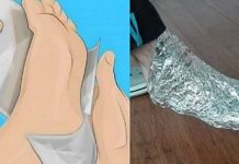 ZAMOTALA SAM NOGE U ALU FOLIJU I DRŽALA SAT VREMENA: REZULTAT JE FENOMENALAN- Evo šta se desilo!