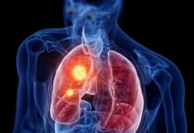 RASTE BROJ ZARAŽENIH HODAJUĆOM UPALOM PLUĆA: Ako imate ove simptome treba da se odmah javite ljekaru