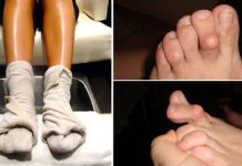 Mnogi se kunu u ovaj prirodni pristup – domaće rešenje koje ublažava tegobe artritisa!