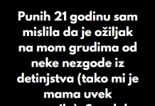 “Punih 21 godinu sam mislila da je ožiljak na mom grudima od neke nezgode iz detinjstva…”