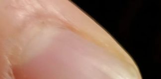 Neočekivano otkriće u salati promenilo je naše veče u restoranu…..