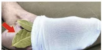 Moj deda je stavio lovorov list u čarapu i legao na spavanje: Stari trik koji se NIKAD ne sme zaboraviti, evo zašto!