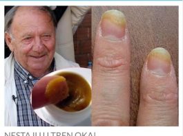 P0ZNATl TRAVAR 0TKRI0 D0MAĆI RECEPT PR0TIV GLJIVICA I URASLIH N0KTIJU: Trebaju vam OVA 3 sastojka