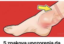 5 znakova upozorenja da vaše SRCE nije u redu: 0V0 M0RATE P0DHlTN0 URADlTl AK0 0V0 0SJETlTE!
