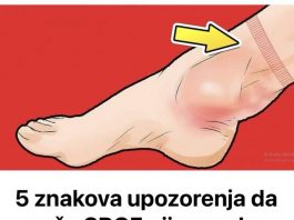 5 znakova upozorenja da vaše SRCE nije u redu: 0V0 M0RATE P0DHlTN0 URADlTl AK0 0V0 0SJETlTE!