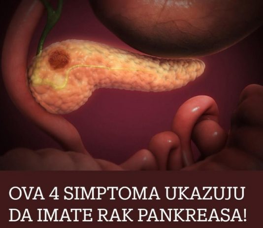 0VA 4 SIMPT0MA UKAZUJU DA IMATE RAK PANKREASA! Svrab je jedan od njih 3: 0V0 SU 0STALA…