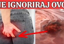 R@k debelog crijeva! UpozoravajućI znakovi I simptomi koje nikada ne smijete ignorirati. R@k debelog crijeva! UpozoravajućI znakovi I simptomi koje nikada ne smijete ignorirati. - featured image