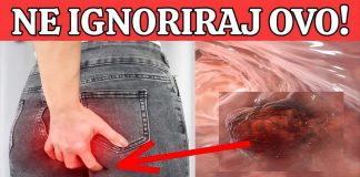 R@k debelog crijeva! UpozoravajućI znakovi I simptomi koje nikada ne smijete ignorirati. R@k debelog crijeva! UpozoravajućI znakovi I simptomi koje nikada ne smijete ignorirati. - featured image
